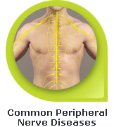 Common Peripheral Nerve Diseases - Warwickshire Neurophysiology Clinic